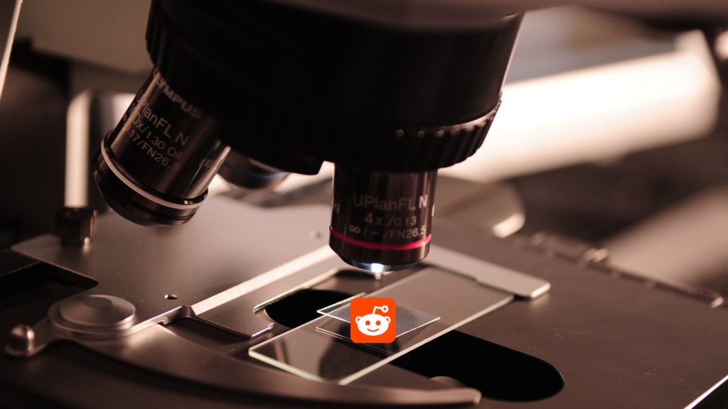 reddit logo under microscope to coincide with experiment section of this blog post